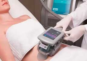 tratamento para gordura localizada com criolipólise durante aplicação de coolsculpting