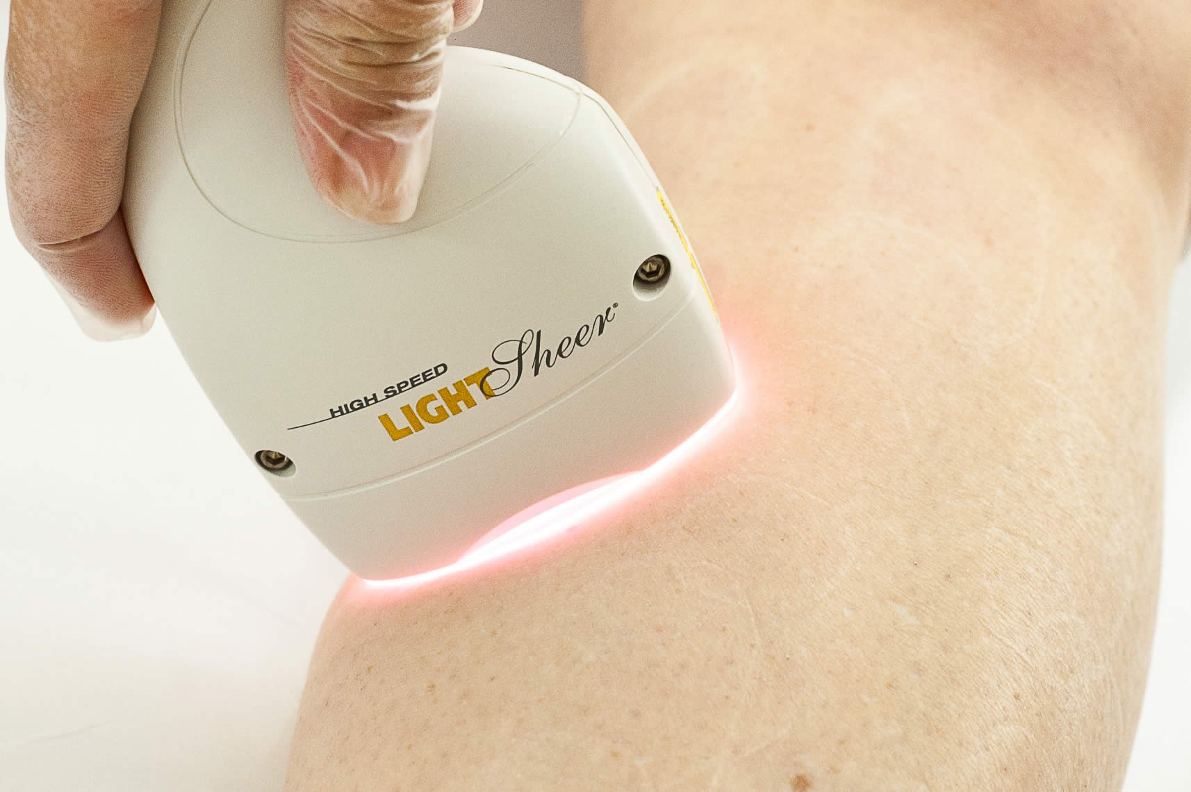 ponteira do aparelho de depilação definitiva a laser lightsheer