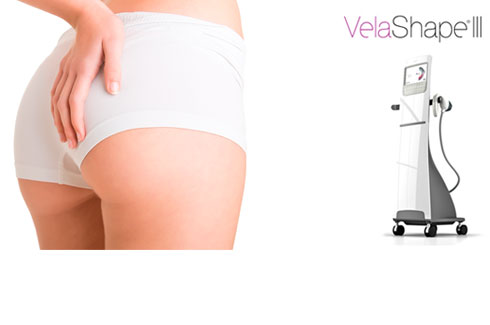 tratamento para celulite e tonificação corporal com velashape 3 no glúteo